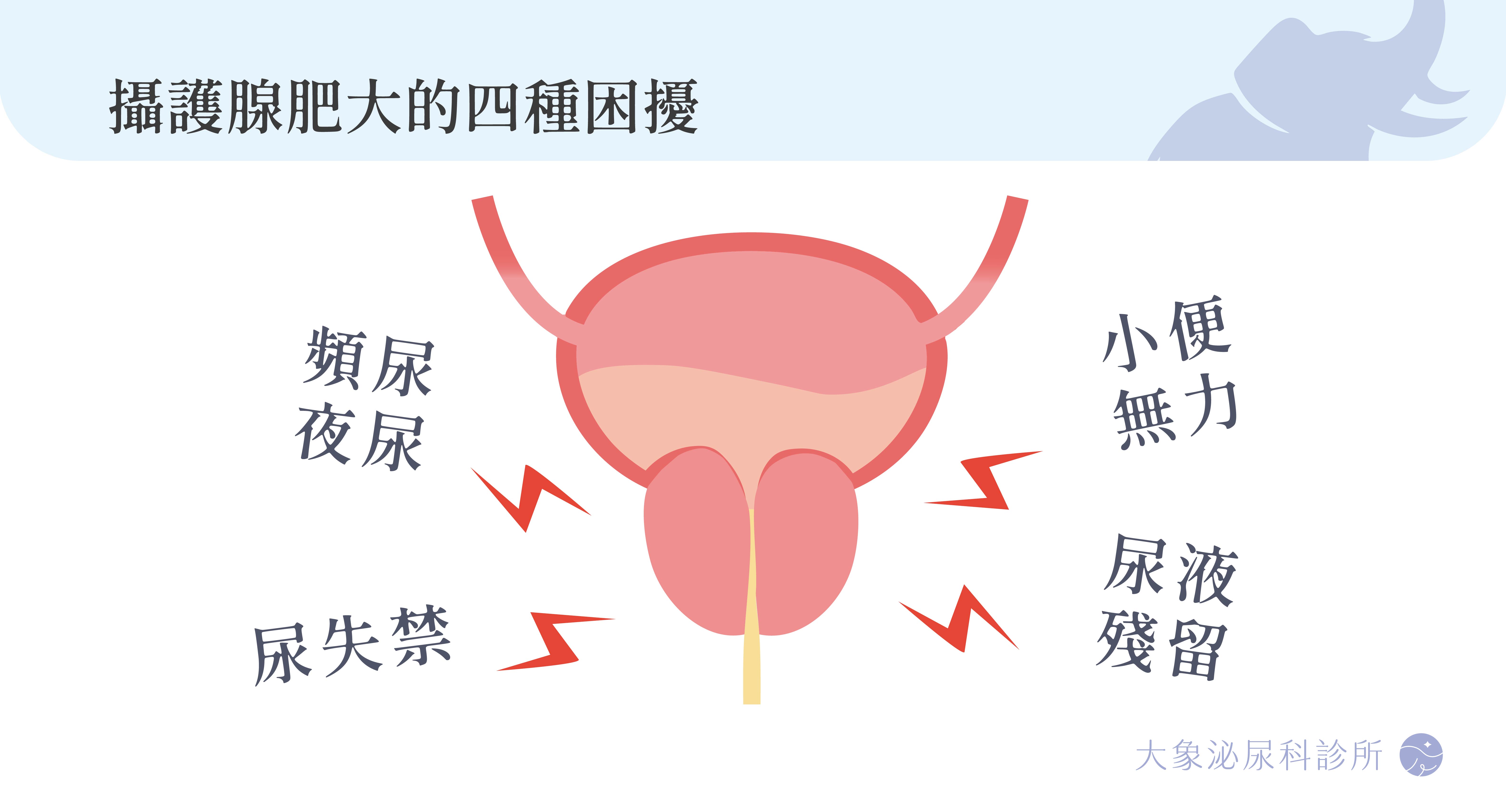 桃園 中壢/泌尿科/大象 - 攝護腺肥大、攝護腺炎是什麼？頻尿、夜尿、排尿困難原因與治療方式