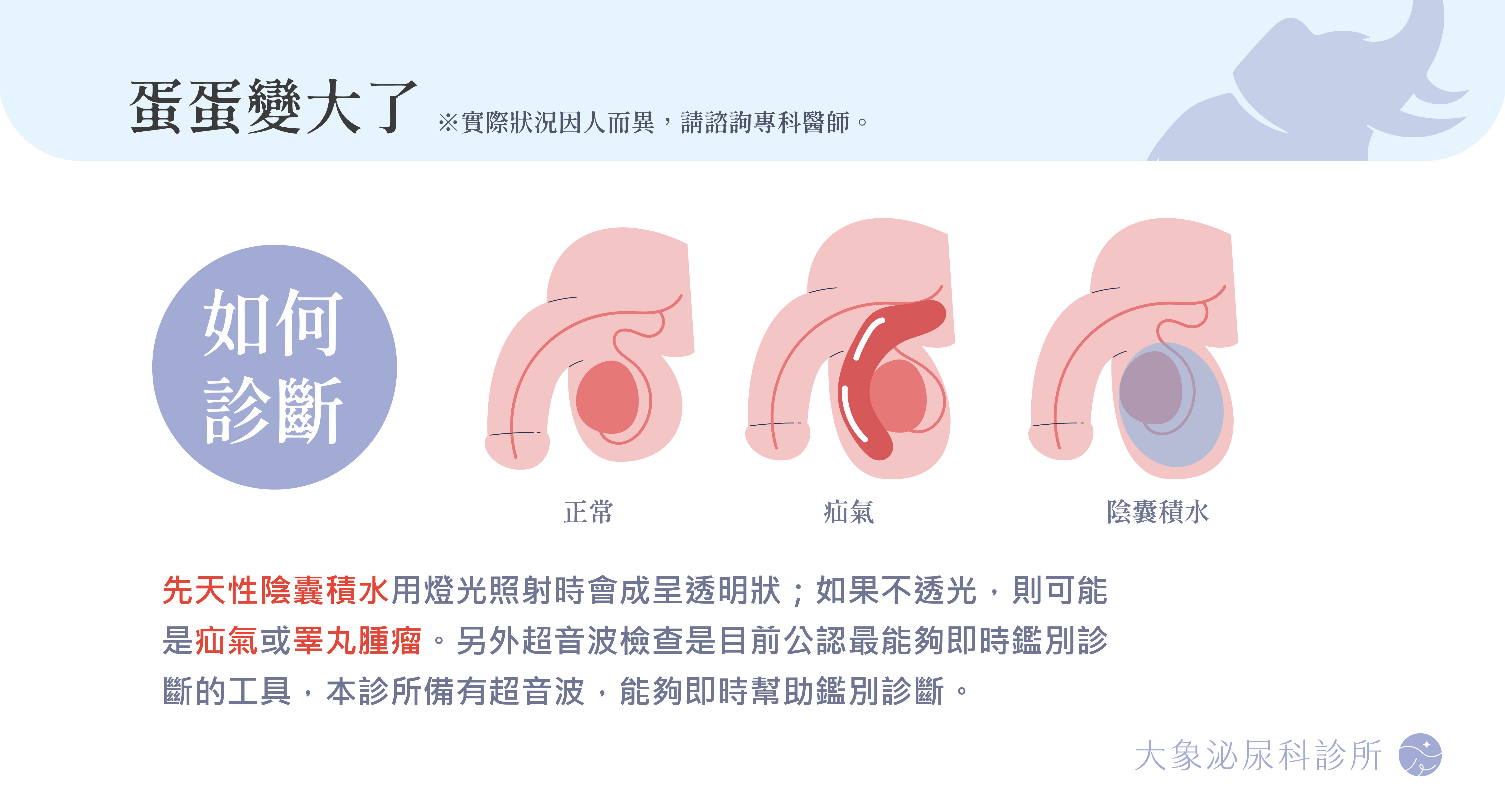 桃園 中壢/泌尿科/大象 - 陰囊水腫