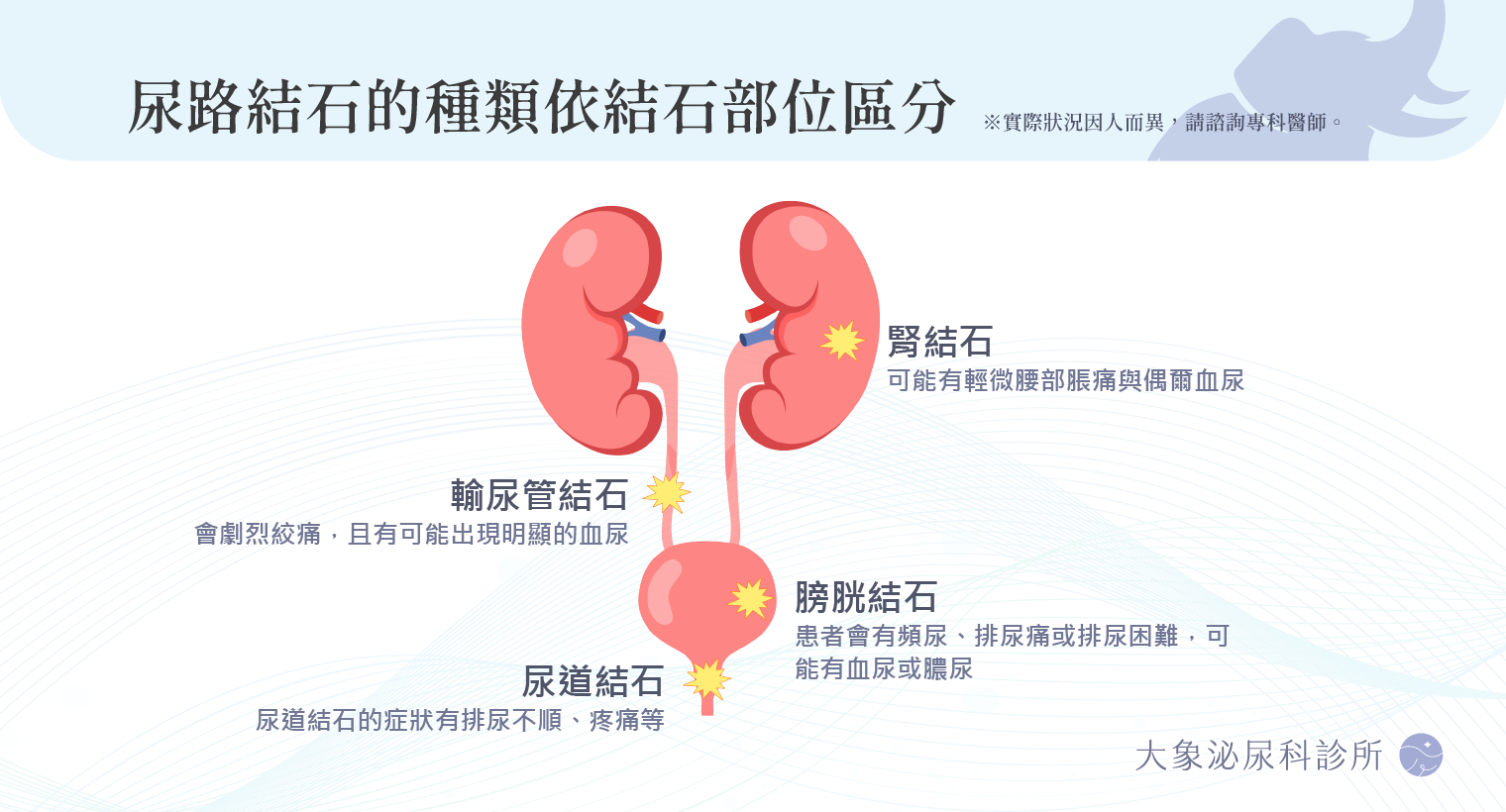 桃園 中壢/泌尿科/大象 - 尿路結石是什麼？結石症狀、原因與治療方式，腰痛、血尿可能是警訊